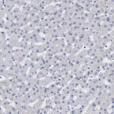 Immunohistochemistry-Paraffin: XIRP1 Antibody [NBP1-85530] - Staining of human liver shows no positivity in hepatocytes as expected.