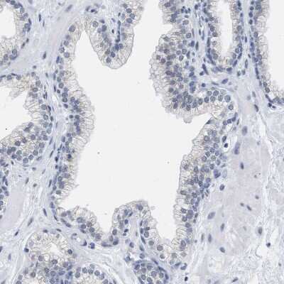 Immunohistochemistry-Paraffin: XIRP1 Antibody [NBP1-85530] - Staining of human prostate shows no positivity in glandular cells as expected.