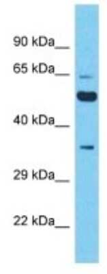Western Blot: XKR5 Antibody [NBP3-09911] - Western blot analysis of XKR5 in A549 Whole Cell lysates. Antibody dilution at 1.0ug/ml