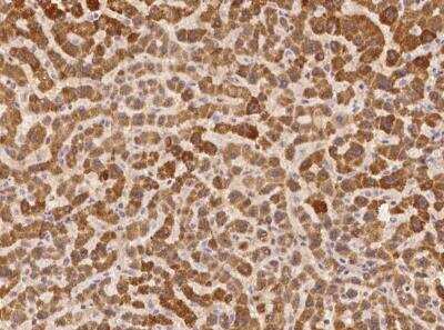 Immunohistochemistry-Paraffin: XKR6 Antibody [NBP3-06015] - Immunochemical staining of human XKR6 in human liver with rabbit polyclonal antibody at 1:100 dilution, formalin-fixed paraffin embedded sections.