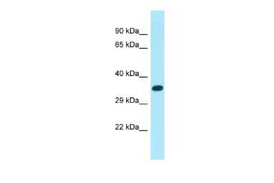 Western Blot: XKR6 Antibody [NBP2-86389] - Host: Rabbit. Target Name: XKR6. Sample Type: MCF7 Whole cell lysates. Antibody Dilution: 1.0ug/ml