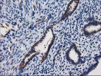 Immunohistochemistry-Paraffin: XLF Antibody (3D6) [NBP2-03275] - Staining of paraffin-embedded Human endometrium tissue using anti-XLF mouse monoclonal antibody.