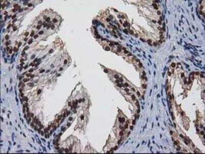 Immunohistochemistry-Paraffin: XLF Antibody (3D6) [NBP2-03275] - Staining of paraffin-embedded Human prostate tissue using anti-XLF mouse monoclonal antibody.