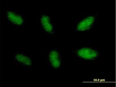 Immunocytochemistry/Immunofluorescence: XLF Antibody [H00079840-B01P] - Analysis of purified antibody to NHEJ1 on HepG2 cell. (antibody concentration 10 ug/ml)