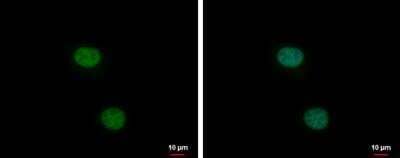 Immunocytochemistry/Immunofluorescence: XLF Antibody [NBP1-31288] - HeLa cells.