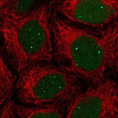 Immunocytochemistry/Immunofluorescence: XLF Antibody [NBP2-55106] - Staining of human cell line CACO-2 shows localization to nucleus & nucleoli fibrillar center.