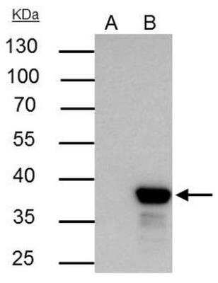 Immunoprecipitation: XLF Antibody [NBP1-31288] - IP samples: Jurkat whole cell extract  A. Control with 3 ug of preimmune Rabbit IgG  B. Immunoprecipitation of XLF protein by 3 ug XLF antibody [N3C3]