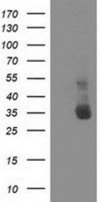 Western Blot: XLF Antibody (OTI3D6) - Azide and BSA Free [NBP2-74876] - HEK293T cells were transfected with the pCMV6-ENTRY control (Left lane) or pCMV6-ENTRY XLF (Right lane) cDNA for 48 hrs and lysed. Equivalent amounts of cell lysates (5 ug per lane) were separated by SDS-PAGE and immunoblotted with anti-XLF.