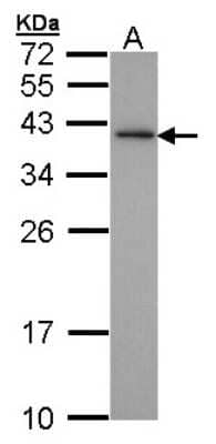 Western Blot XLF Antibody