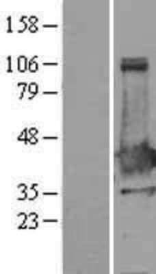 Western Blot XLF Overexpression Lysate