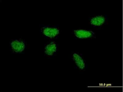 Immunocytochemistry/Immunofluorescence: XPA Antibody [H00007507-B01P] - Analysis of purified antibody to XPA on HeLa cell. (antibody concentration 10 ug/ml)