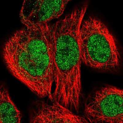 Immunocytochemistry/Immunofluorescence: XPB Antibody [NBP2-58758] - Staining of human cell line A-431 shows localization to nucleoplasm.