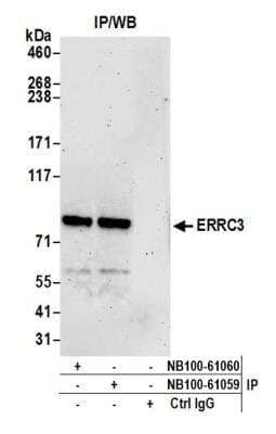 Immunoprecipitation: XPB Antibody [NB100-61059] - Detection of human ERRC3 by western blot of immunoprecipitates. Samples: Whole cell lysate (1.0 mg per IP reaction; 20% of IP loaded) from HEK293T cells prepared using NETN lysis buffer. Antibodies: Affinity purified rabbit anti-ERRC3 antibody NB100-61059 used for IP at 3 ug per reaction. ERRC3 was also immunoprecipitated by rabbit anti-ERRC3 antibody NB100-61060. For blotting immunoprecipitated ERRC3, NB100-61060 was used at 1 ug/ml. Detection: Chemiluminescence with an exposure time of 3 minutes.