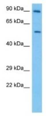 Western Blot: XPB Antibody [NBP3-10102] - Western blot analysis of XPB in Human LN18 Whole Cell lysates. Antibody dilution at 1ug/ml