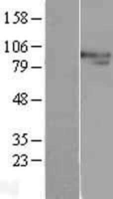 Western Blot: XPB Overexpression Lysate (Adult Normal) [NBL1-10321] Left-Empty vector transfected control cell lysate (HEK293 cell lysate); Right -Over-expression Lysate for XPB.