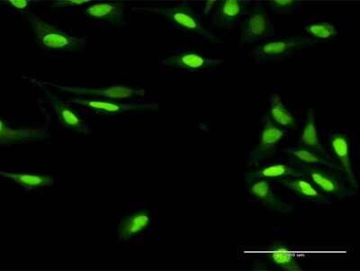 Immunocytochemistry/Immunofluorescence: XPE/DDB2 Antibody [H00001643-D01P] - Analysis of antibody to DDB2 on HeLa cell. Antibody concentration 20 ug/ml.