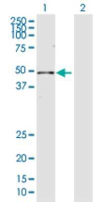 Western Blot: XPE/DDB2 Antibody [H00001643-D01P] - Analysis of DDB2 expression in transfected 293T cell line by DDB2 polyclonal antibody.Lane 1: DDB2 transfected lysate(47.90 KDa).Lane 2: Non-transfected lysate.