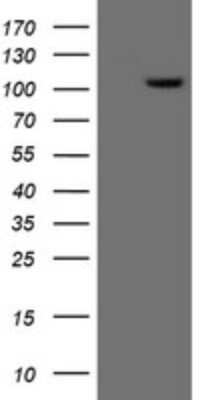 Western Blot: XPF Antibody (3H7) [NBP2-45503] - Analysis of HEK293T cells were transfected with the pCMV6-ENTRY control (Left lane) or pCMV6-ENTRY XPF.