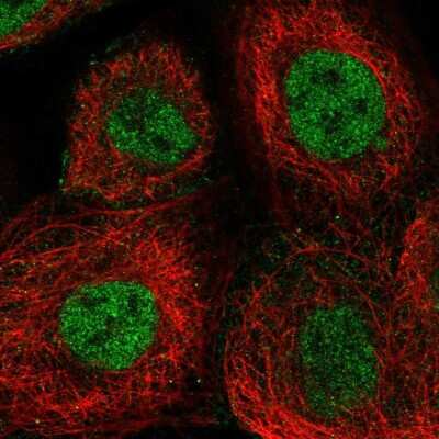 Immunocytochemistry/ Immunofluorescence XPF Antibody