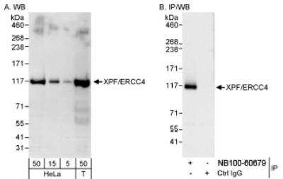 Western Blot XPF Antibody