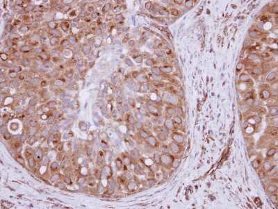 Immunohistochemistry-Paraffin XPO6 Antibody