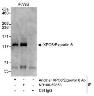 Immunoprecipitation: XPO6 Antibody [NB100-59853] - Detection of Human XPO6/Exportin 6 by Western Blot of Immunoprecipitates. Samples: Whole cell lysate (1 mg for IP, 20% of IP loaded) from HeLa cells. Antibodies: Affinity purified rabbit anti-XPO6/Exportin 6 antibody NB100-59853 used for WB at 1 mcg/ml used for IP at 3 mcg/mg lysate. XPO6/Exportin 6 was also immunoprecipitated by another rabbit anti-XPO6/Exportin 6 antibody, which recognizes an upstream epitope.
