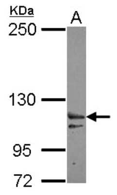Western Blot XPO6 Antibody
