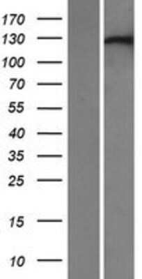 Western Blot: XPO6 Overexpression Lysate (Adult Normal) [NBP2-07210] Left-Empty vector transfected control cell lysate (HEK293 cell lysate); Right -Over-expression Lysate for XPO6.