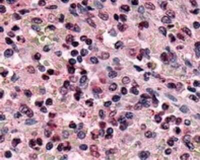 Immunohistochemistry-Paraffin: XPR1 Antibody [NBP2-29487] - Analysis of anti-XPR1 antibody with spleen at 8 ug/ml.