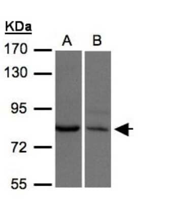 Western Blot: XPR1 Antibody [NBP1-31083] - Sample(30 ug of whole cell lysate)A:H1299B:Hep G2 7. 5% SDS PAGE, antibody diluted at 1:500.