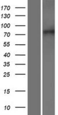 Western Blot: XPR1 Overexpression Lysate (Adult Normal) [NBP2-07832] Left-Empty vector transfected control cell lysate (HEK293 cell lysate); Right -Over-expression Lysate for XPR1.