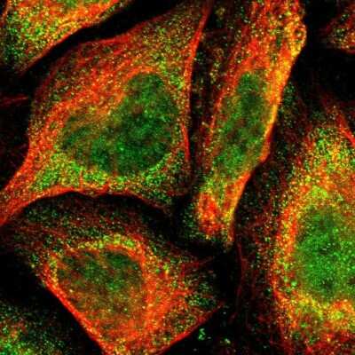 Immunocytochemistry/Immunofluorescence: XPV/DNA polymerase eta Antibody [NBP1-87165] - Staining of human cell line U-2 OS shows localization to nucleoplasm & cytosol. Antibody staining is shown in green.