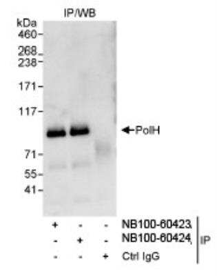 Immunoprecipitation: XPV/DNA polymerase eta Antibody [NB100-60423] - Detection of Human PolH by Western Blot of Immunoprecipitates.  Samples: Whole cell lysate (1 mg for IP, 20% of IP loaded) from HeLa cells. Antibodies: Affinity purified rabbit anti-PolH antibody NB100-60423 used for IP at 3 mcg/mg lysate. PolH was also immunoprecipitated by rabbit anti-PolH antibody NB100-60424, which recognizes a downstream epitope. Detection: Chemiluminescence with an exposure time of 10 seconds.