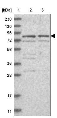 Western Blot: XPV/DNA polymerase eta Antibody [NBP1-87166] - Lane 1: Marker  [kDa] 230, 130, 95, 72, 56, 36, 28, 17, 11.  Lane 2: Human cell line RT-4.  Lane 3: Human cell line U-251MG sp