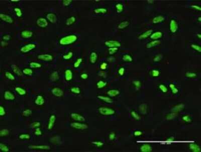 Immunocytochemistry/Immunofluorescence: XRCC1 Antibody [H00007515-D01P] - Analysis of antibody to XRCC1 on HeLa cell. Antibody concentration 10 ug/ml.