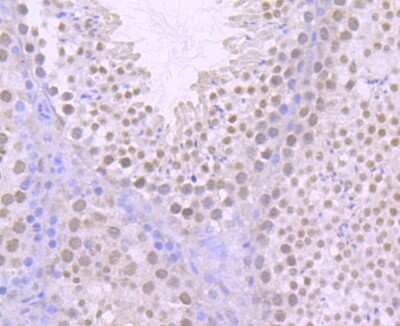 Immunohistochemistry-Paraffin: XRCC1 Antibody (JA11-47) [NBP2-66790] - Analysis of paraffin-embedded mouse testis tissue using anti-XRCC1 antibody. Counter stained with hematoxylin.