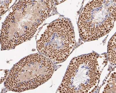 Immunohistochemistry-Paraffin: XRCC1 Antibody (JA11-47) [NBP2-66790] - Immunohistochemical analysis of paraffin-embedded mouse testis tissue using anti- XRCC1 antibody. Counter stained with hematoxylin.