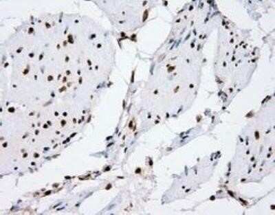 Immunohistochemistry: XRCC1 Antibody (OTI2F8) - Azide and BSA Free [NBP2-74891] - staining of paraffin-embedded bladder tissue using anti-RC204952 mouse monoclonal antibody.