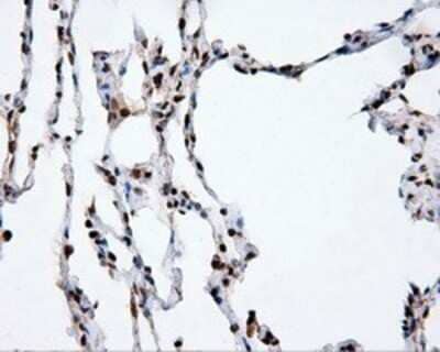 Immunohistochemistry: XRCC1 Antibody (OTI2F8) - Azide and BSA Free [NBP2-74891] - Staining of paraffin-embedded lung tissue using anti-XRCC1 mouse monoclonal antibody.