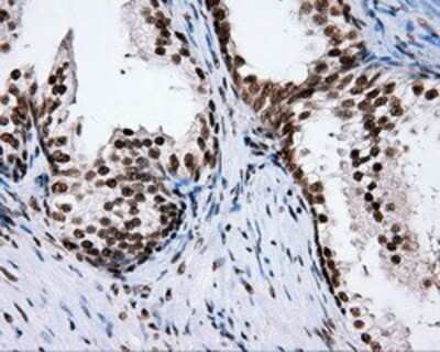 Immunohistochemistry: XRCC1 Antibody (OTI2F8) - Azide and BSA Free [NBP2-74891] - Staining of paraffin-embedded prostate tissue using anti-XRCC1 mouse monoclonal antibody.