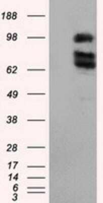 Western Blot: XRCC1 Antibody (OTI2F8) - Azide and BSA Free [NBP2-74891] - HEK293T cells were transfected with the pCMV6-ENTRY control (Left lane) or pCMV6-ENTRY XRCC1 (Right lane) cDNA for 48 hrs and lysed. Equivalent amounts of cell lysates (5 ug per lane) were separated by SDS-PAGE and immunoblotted with anti-XRCC1.