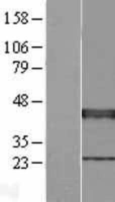 Western Blot: XRCC3 Overexpression Lysate (Adult Normal) [NBP2-08249] Left-Empty vector transfected control cell lysate (HEK293 cell lysate); Right -Over-expression Lysate for XRCC3.