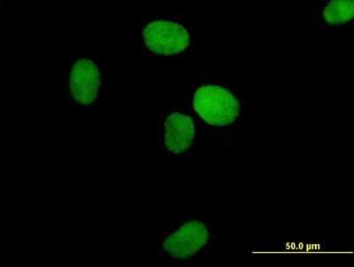 Immunocytochemistry/Immunofluorescence: XRCC4 Antibody [H00007518-B01P] - Analysis of purified antibody to XRCC4 on HeLa cell. (antibody concentration 10 ug/ml)