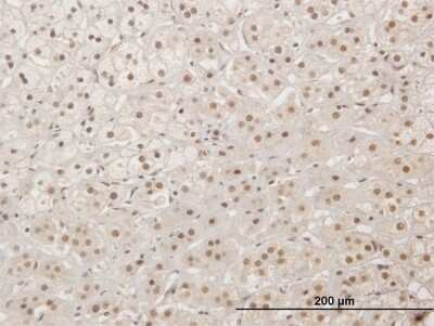 Immunohistochemistry-Paraffin: XRCC4 Antibody [H00007518-B01P] - Analysis of purified antibody to XRCC4 on formalin-fixed paraffin-embedded human adrenal gland. (antibody concentration 3 ug/ml)