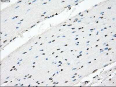 Immunohistochemistry: XRCC4 Antibody (OTI4H9) - Azide and BSA Free [NBP2-74896] - Staining of paraffin-embedded colon tissue using anti-XRCC4 mouse monoclonal antibody.