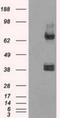 Western Blot: XRCC4 Antibody (OTI4H9) - Azide and BSA Free [NBP2-74896] - HEK293T cells were transfected with the pCMV6-ENTRY control (Left lane) or pCMV6-ENTRY XRCC4 (Right lane) cDNA for 48 hrs and lysed. Equivalent amounts of cell lysates (5 ug per lane) were separated by SDS-PAGE and immunoblotted with anti-XRCC4.