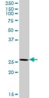 Western Blot: XRCC6BP1 Antibody [H00091419-D01P] - Analysis of XRCC6BP1 expression in HepG2.