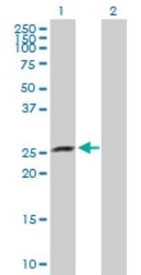 Western Blot: XRCC6BP1 Antibody [H00091419-D01P] - Analysis of XRCC6BP1 expression in transfected 293T cell line by XRCC6BP1 polyclonal antibody.Lane 1: XRCC6BP1 transfected lysate(28.10 KDa).Lane 2: Non-transfected lysate.
