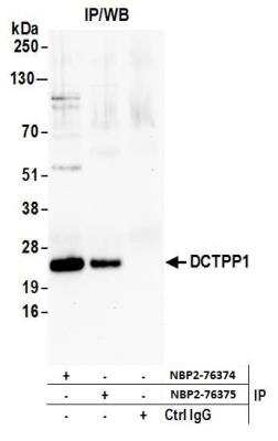 Immunoprecipitation: XTP3TPA Antibody [NBP2-76374] - Samples: Whole cell lysate (1.0 mg per IP reaction; 20% of IP loaded) from HEK293T cells prepared using NETN lysis buffer. Antibodies: Affinity purified rabbit anti-DCTPP1 antibody NBP2-76374 used for IP at 100 ul per reaction. DCTPP1 was also immunoprecipitated by rabbit anti-DCTPP1 antibody NBP2-76375. For blotting immunoprecipitated DCTPP1, NBP2-76374 was used at 1:40. Detection: Chemiluminescence with an exposure time of 10 seconds.