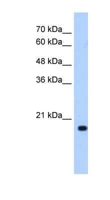 Western Blot: XTP3TPA Antibody [NBP1-55335] - Titration: 0.5ug/ml Positive Control: Transfected 293T.